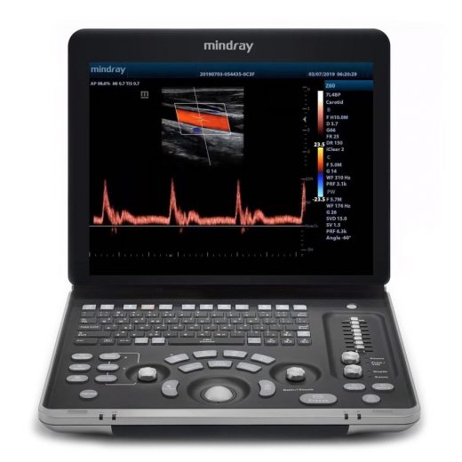 Mindray-Z60-Digital-Ultrasound-System-1