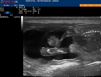 extremidades-posteriores-en-un-feto